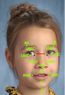 Standardized Measurement of Facial and Vocal Affect Production
